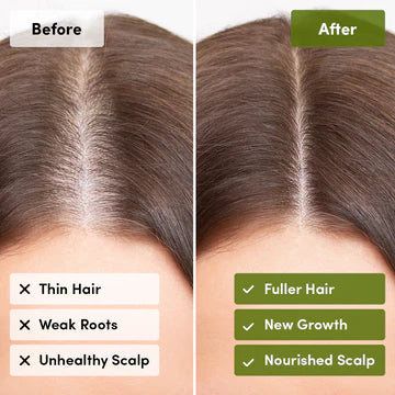 Rosemary Scalp & Hair Mist 