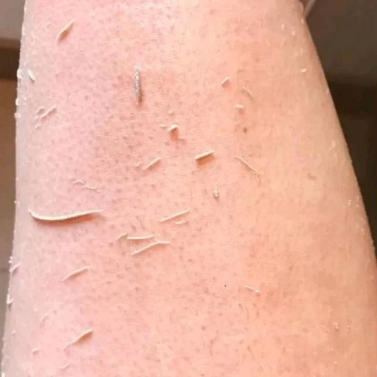A close-up of human skin with dry, flaky peeling skin and small hair-like strands visible.